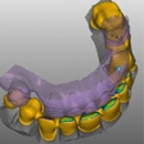 exocad2-130x130 Solutions cad cam : logiciel exocad