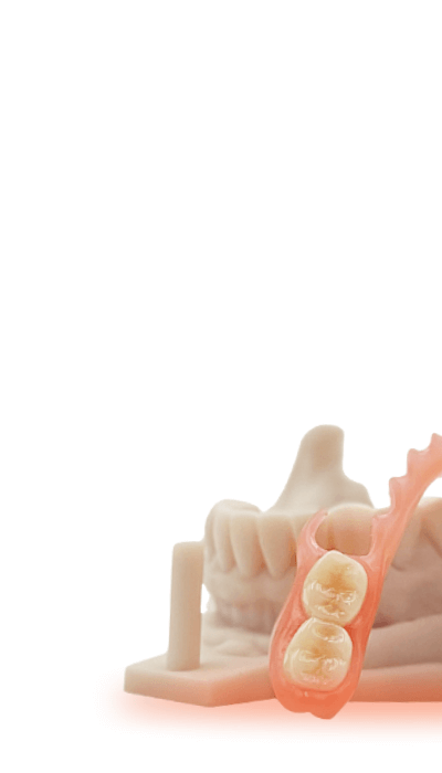 Scan Body Inlay Core pour la dentisterie