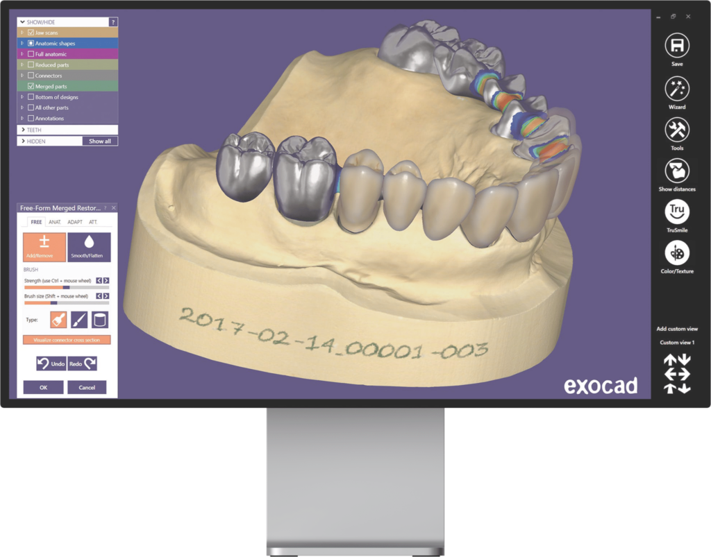 Exocad screen