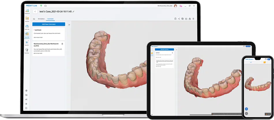 Scanner intra oral Medit