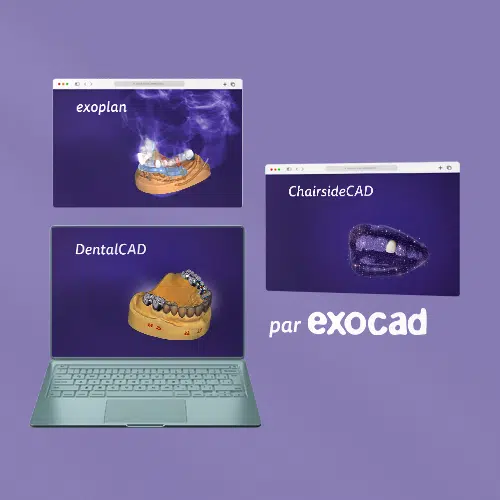 Exocad