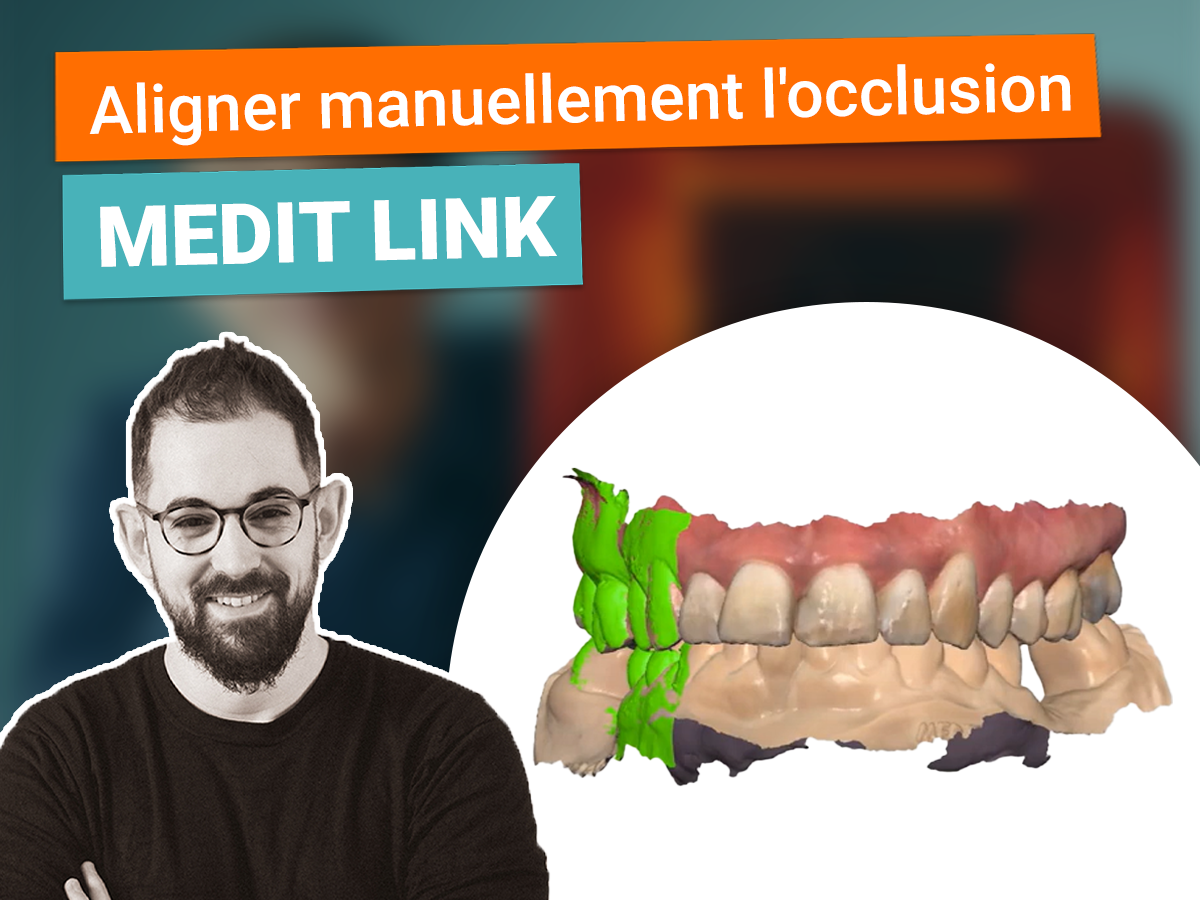 Miniature aligner manuellement l'occlusion sur Medit Link