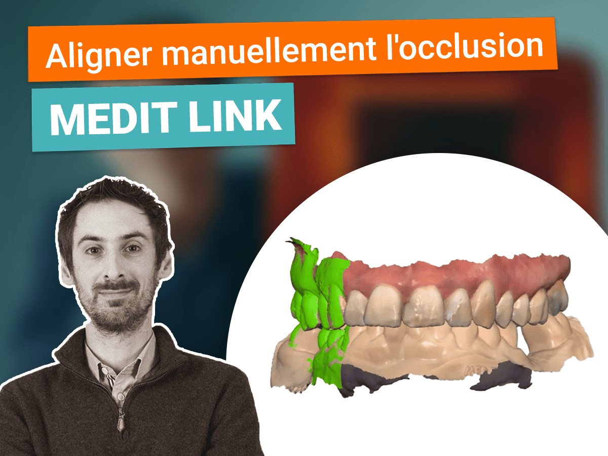 Miniature aligner manuellement l'occlusion sur Medit Link