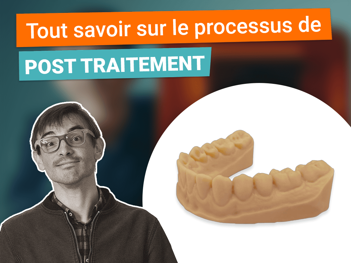 Miniature tout savoir sur le processus de post traitement