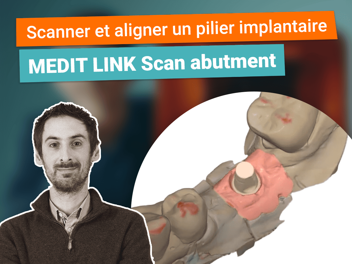 Miniature scanner et aligner un plier implantaire