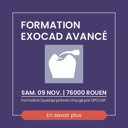 Nos formateurs, Arnaud et Chloé, vous partagent leur expertise pour vous guider dans la maitrise du logiciel Exocad en mode expert et vous accompagner dans la conception des cas plus complexes.