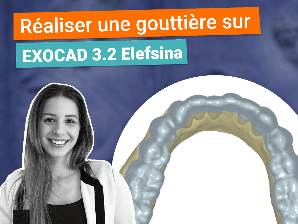 Gouttière sur Exocad 3.2 Elefsina