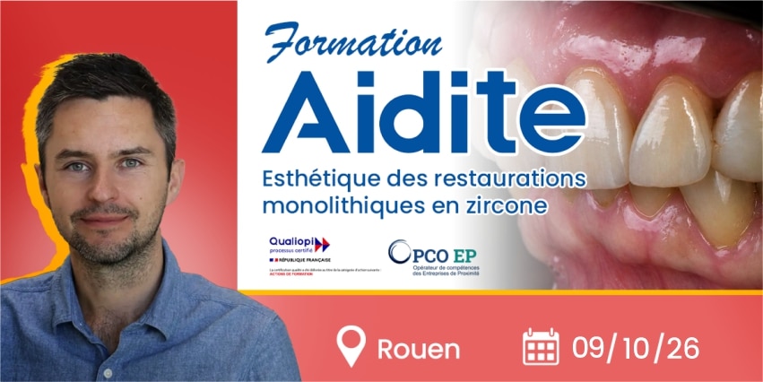 Esthétique de restaurations monolithiques en zircone